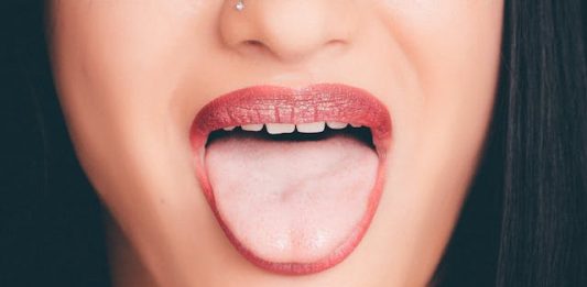 helicobacter pylori-sintomi della lingua