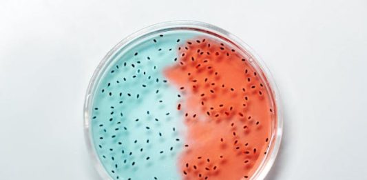 migliori fermenti lattici per il colon irritabile