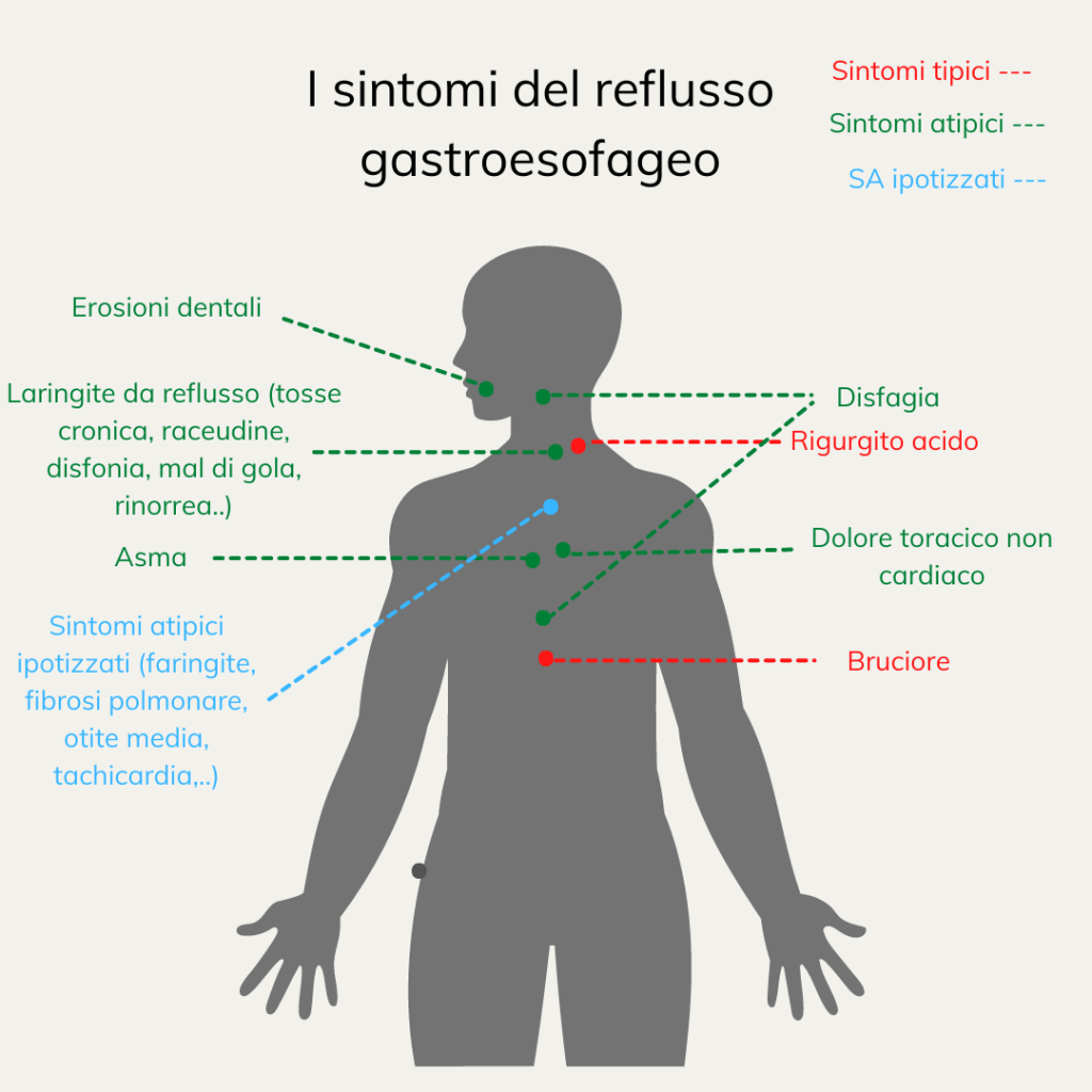 Reflusso gastroesofageo: sintomi 