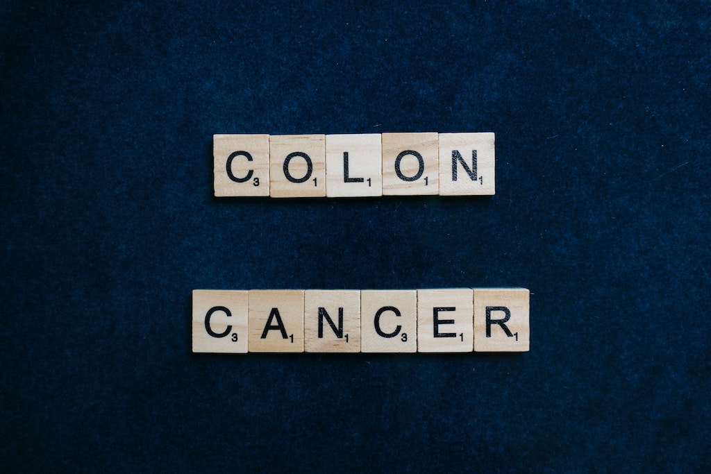 cancro colon